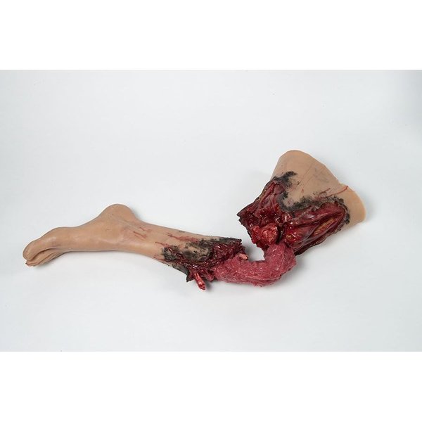 Moulage Science & Training Partial Leg Amputation, Left, Light MST-33-02-L01